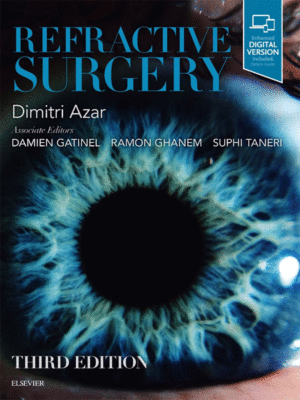 Refractive Surgery by Azar, 3rd Edition