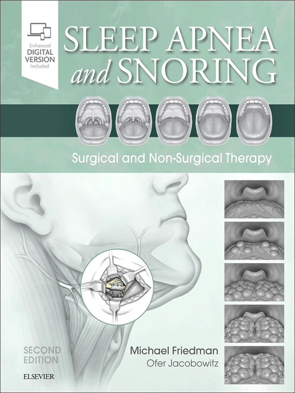 Sleep Apnea and Snoring by Friedman: Surgical and Non-Surgical Therapy, 2nd Edition