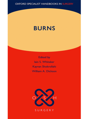 Burns (Oxford Specialist Handbooks in Surgery)