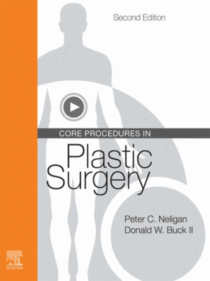Core Procedures in Plastic Surgery by Neligan, 2nd Edition