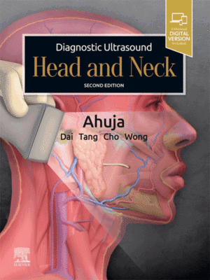 Diagnostic Ultrasound: Head and Neck by Ahuja, 2nd Edition