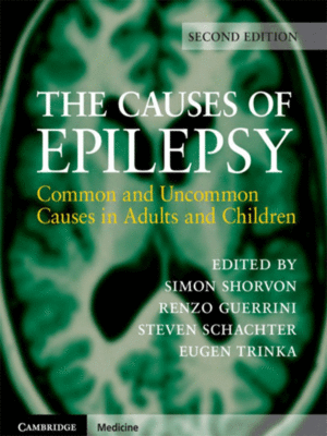 The Causes of Epilepsy: Common and Uncommon Causes in Adults and Children, 2nd Edition