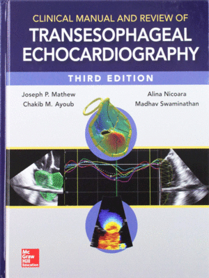 Clinical Manual and Review of Transesophageal Echocardiography, 3rd Edition