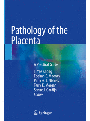 Pathology of the Placenta: A Practical Guide