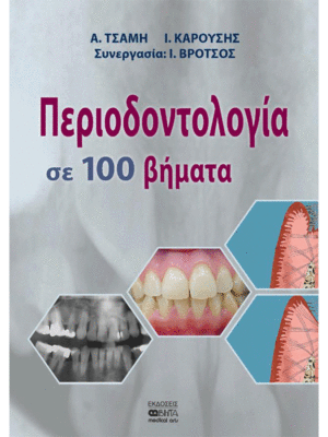 Περιοδοντολογία σε 100 Βήματα