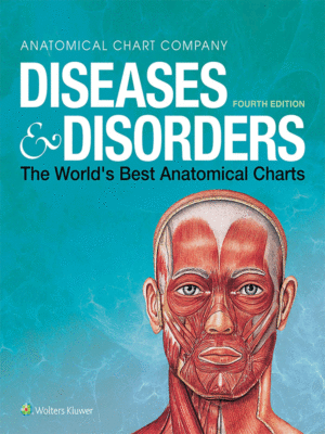 Anatomical Chart Company: Diseases and Disorders, 4th Edition