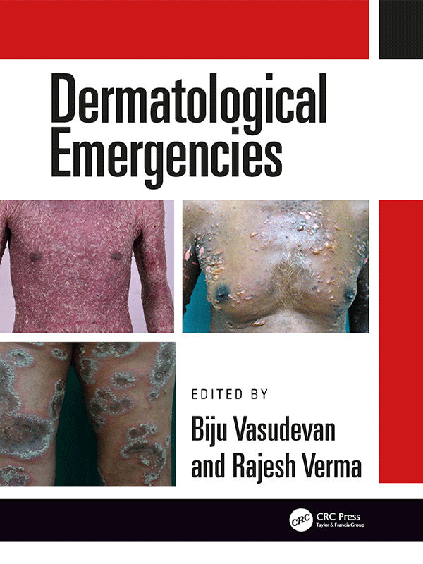 Dermatological Emergencies Dermatological Emergencies