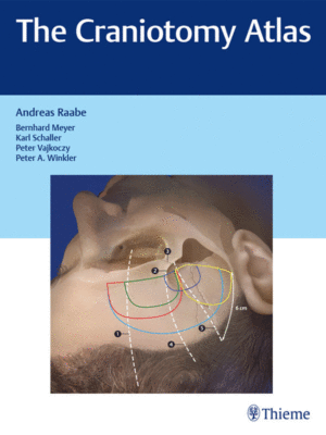 The Craniotomy Atlas by Raabe