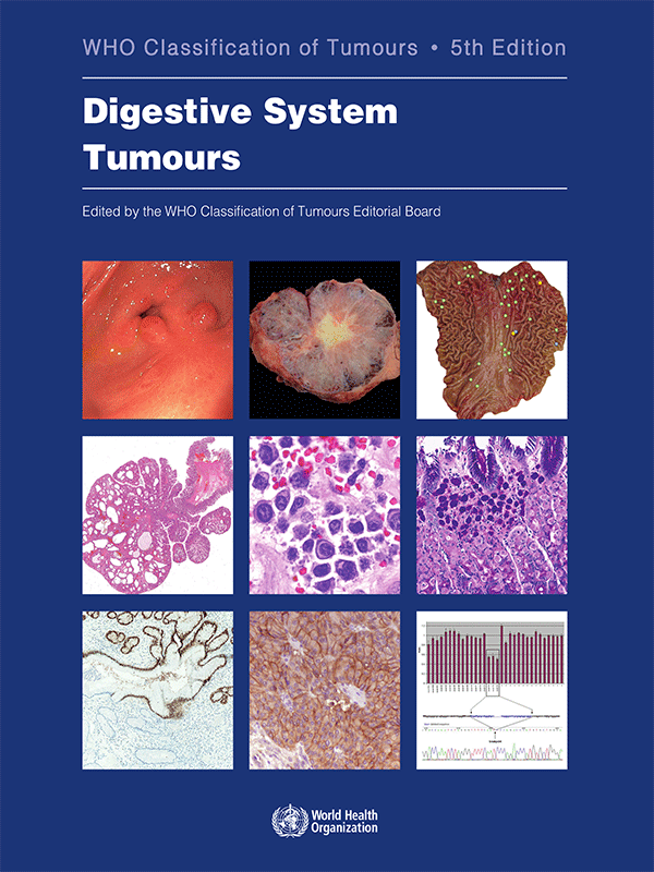 WHO Classification of Tumours: Digestive System Tumours, 5th Edition