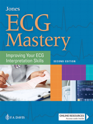 ECG Mastery by Jones: Improving Your ECG Interpretation Skills, 2nd Edition