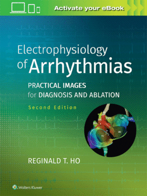 Electrophysiology of Arrhythmias