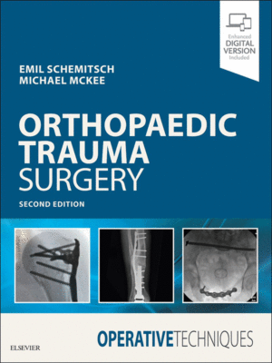 Operative Techniques: Orthopaedic Trauma Surgery, 2nd Edition