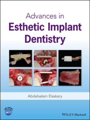 Advances in Esthetic Implant Dentistry