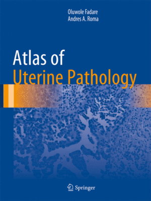 Atlas of Uterine Pathology by Fadare