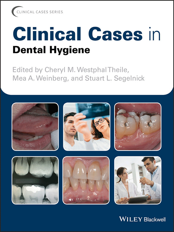 Clinical Cases in Dental Hygiene Clinical Cases in Dental Hygiene