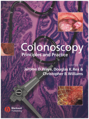 Colonoscopy by Waye: Principles and Practice