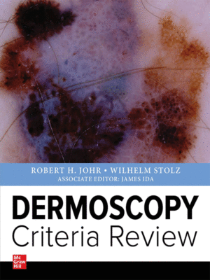 Dermoscopy Criteria Review by Johr