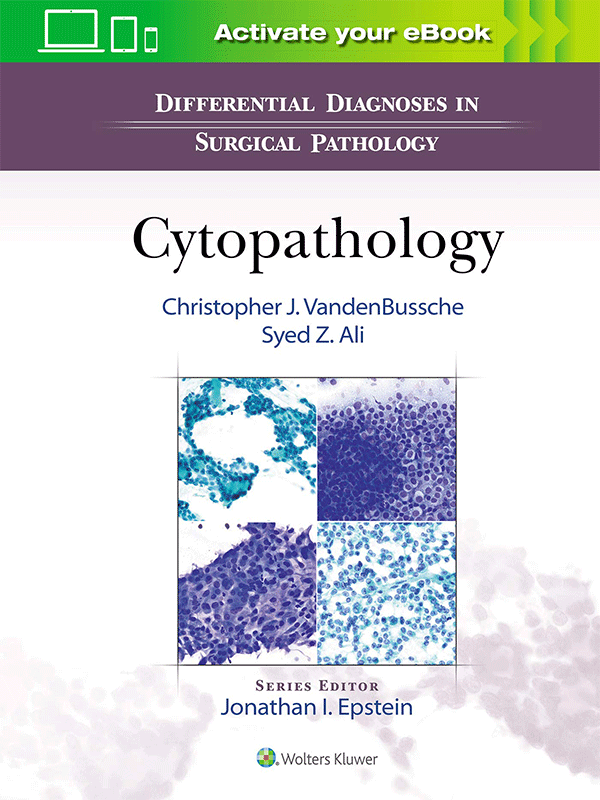 Differential Diagnoses in Surgical Pathology Cytopathology Vasiliadis Medical Books