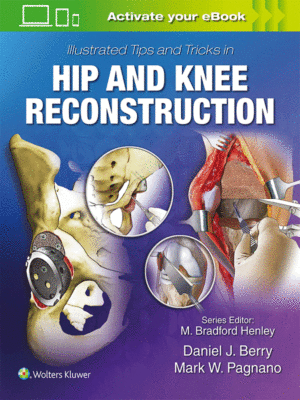 Illustrated Tips and Tricks in Hip and Knee Reconstruction by Berry