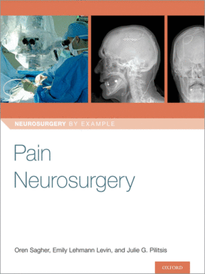 Pain Neurosurgery (Neurosurgery by Example)
