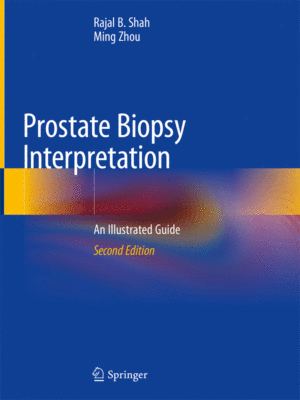 Prostate Biopsy Interpretation by Shah, 2nd Edition