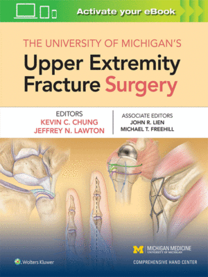 The University of Michigan's Upper Extremity Fracture Surgery by Chung