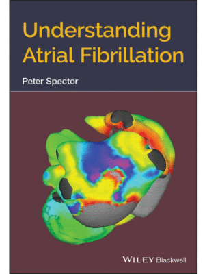 Understanding Atrial Fibrillation by Spector