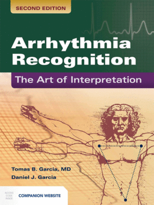 Arrhythmia Recognition by Garcia: The Art of Interpretation, 2nd Edition
