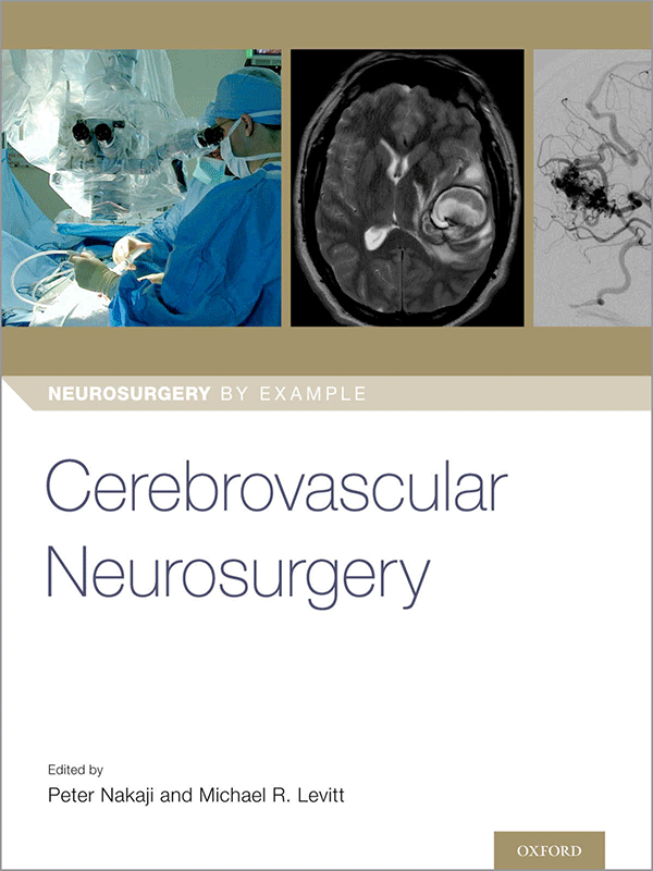 Cerebrovascular Neurosurgery (Neurosurgery by Example)