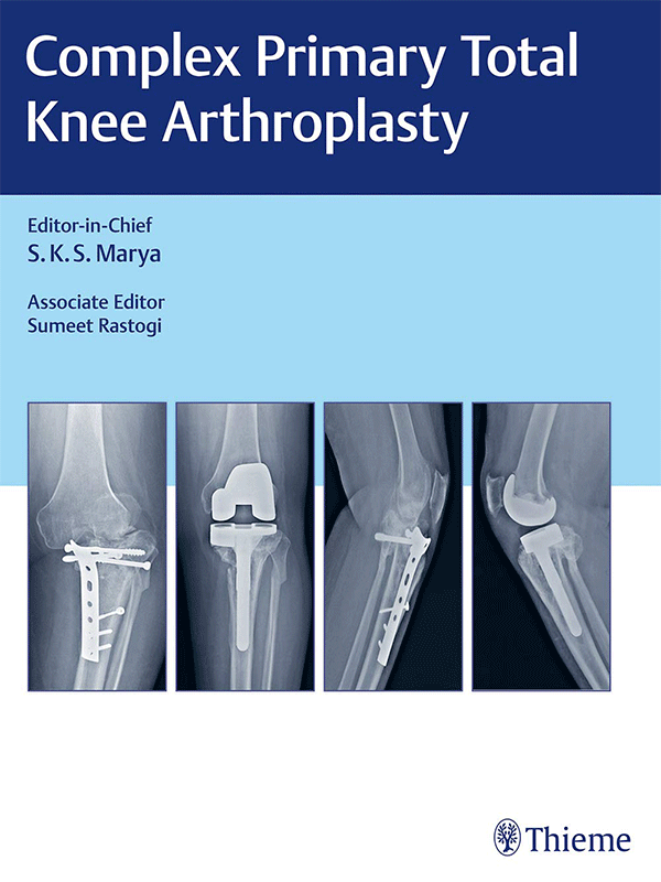 Complex Primary Total Knee Arthroplasty