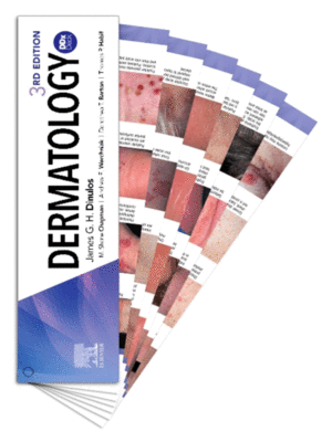 Dermatology DDX Deck, 3rd Edition