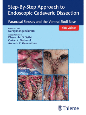 Step-By-Step Approach to Endoscopic Cadaveric Dissection: Paranasal Sinuses and the Ventral Skull Base