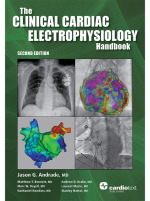The Clinical Cardiac Electrophysiology Handbook, 2nd Edition