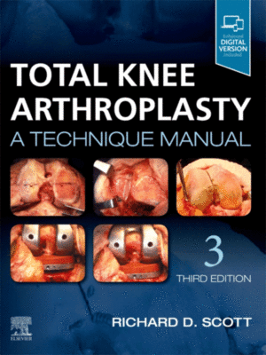 Total Knee Arthroplasty by Scott: A Technique Manual, 3rd Edition