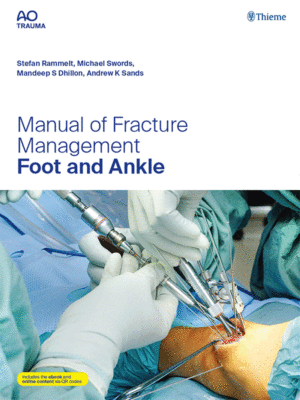 AO Manual of Fracture Management: Foot and Ankle