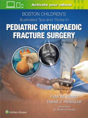 Boston Children’s Illustrated Tips and Tricks in Pediatric Orthopaedic Fracture Surgery
