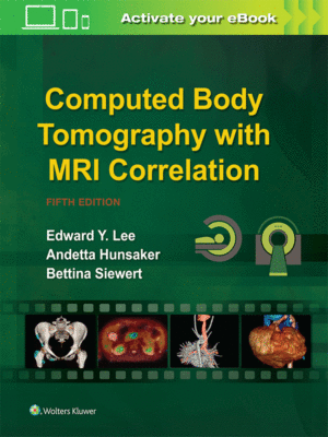 Computed Body Tomography with MRI Correlation by Lee, 5th Edition