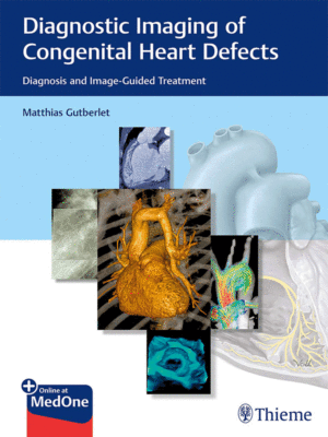 Diagnostic Imaging of Congenital Heart Defects: Diagnosis and Image-Guided Treatment