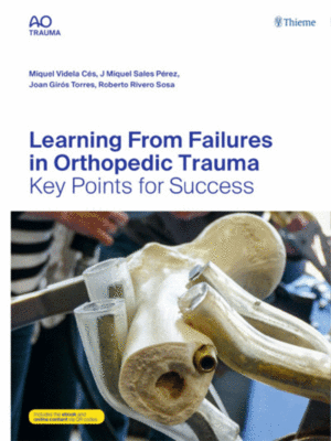 Learning From Failures in Orthopedic Trauma: Key Points for Success