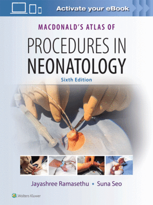 MacDonald's Atlas of Procedures in Neonatology, 6th Edition