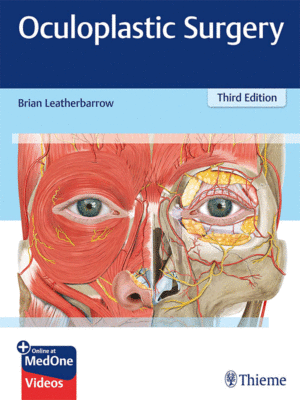 Oculoplastic Surgery by Leatherbarrow, 3rd Edition