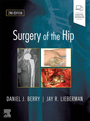 Surgery of the Hip by Berry & Lieberman, 2nd Edition