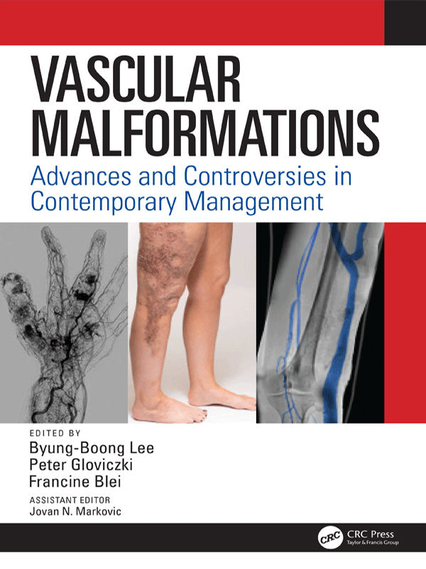 Vascular Malformations: Advances and Controversies in Contemporary Management Vascular Malformations: Advances and Controversies in Contemporary Management