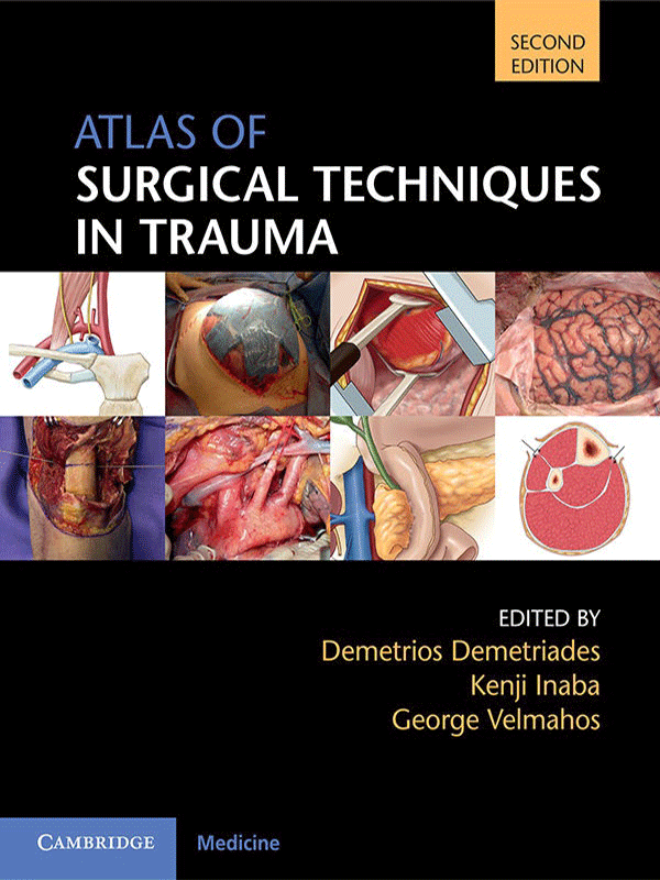 Atlas of Surgical Techniques in Trauma by Demetriades, 2nd Edition