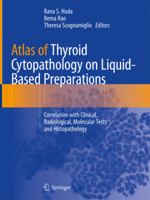 Atlas of Thyroid Cytopathology on Liquid-Based Preparations