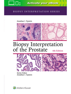 Biopsy Interpretation of the Prostate by Epstein, 6th Edition