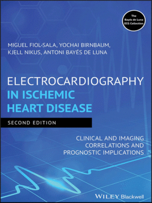 Electrocardiography in Ischemic Heart Disease: Clinical and Imaging Correlations and Prognostic Implications, 2nd Edition