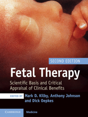 Fetal Therapy: Scientific Basis and Critical Appraisal of Clinical Benefits, 2nd Edition