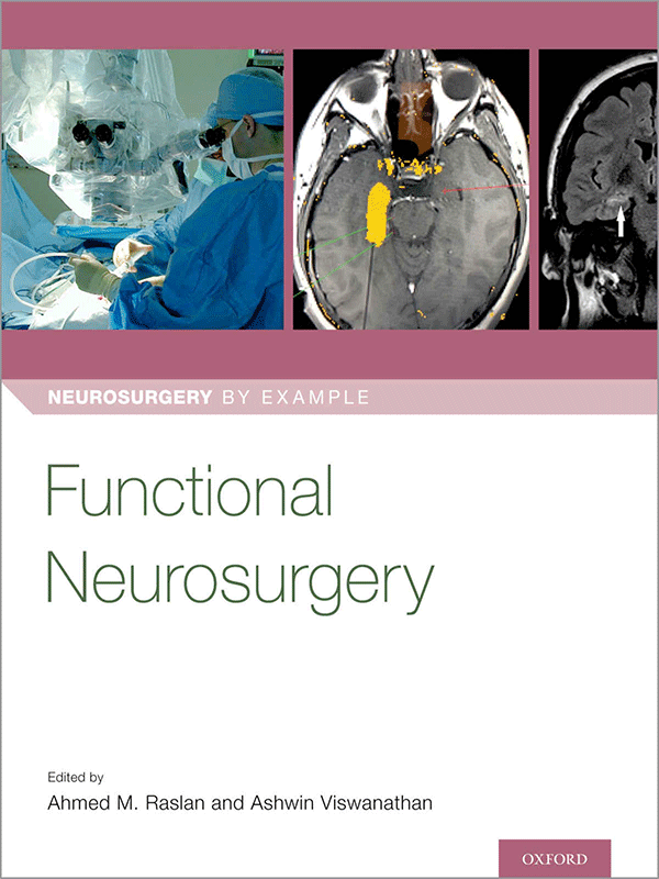 Functional Neurosurgery: Neurosurgery by Example