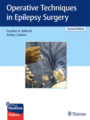 Operative Techniques in Epilepsy Surgery, 2nd Edition